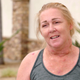 Image for article titled Dr. Pimple Popper Goes Head-to-Head With a Nipple... on Someone's Head
